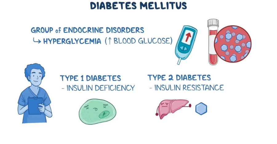 a diagram of diabetes mellitus